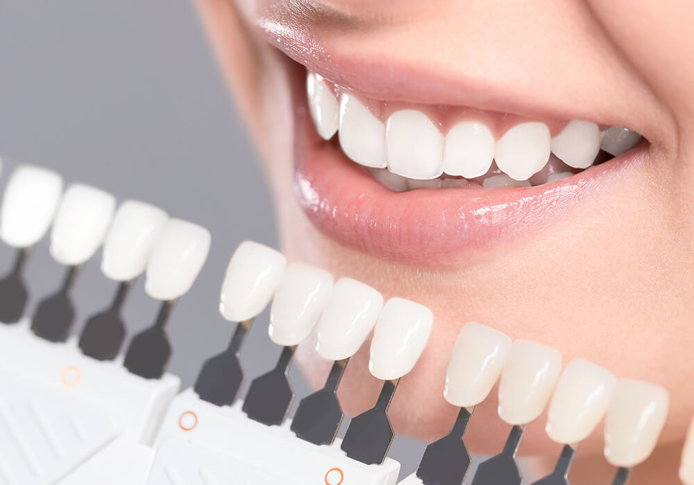 ホワイトニング